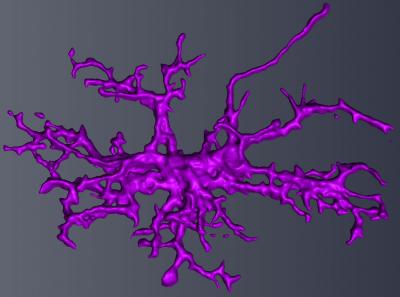 Autism in boys: Enlarged microglia