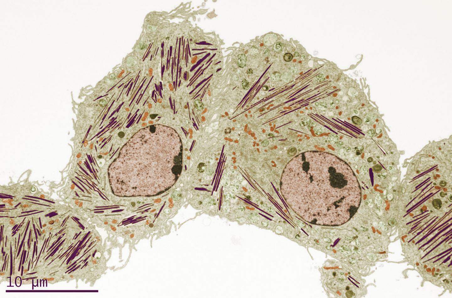 Image of Gaucher's Disease in Mouse Lung