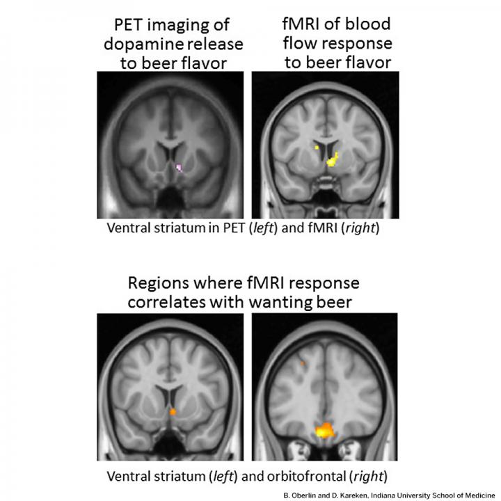 Brain Scans of Response to Beer Taste