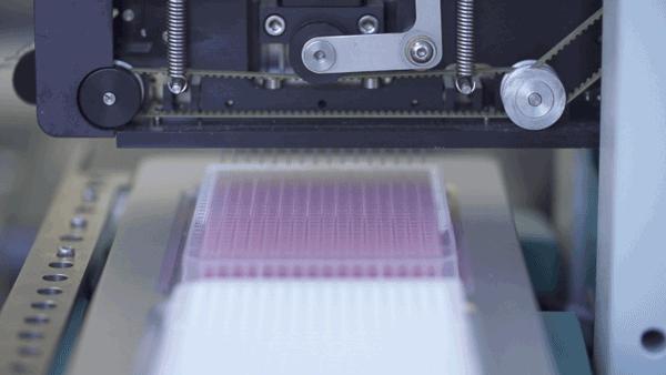 High-Throughput Screening Leads to Cancer Breakthrough