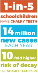 Impact of chalky teeth