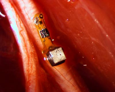 Sensor on Nerve Fiber