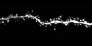 A dendrite – an extension of a neuron - from a 12-month-old human cerebral cortex neuron, grown from human stem cells and transplanted into a mouse cerebral cortex.