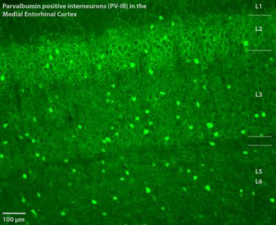 A Microscopic View of the Entorhinal Cortex