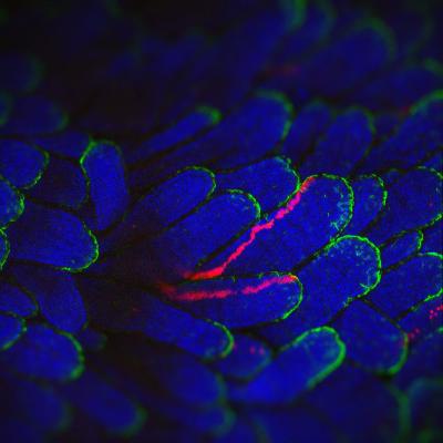 Cells with Mutations Don