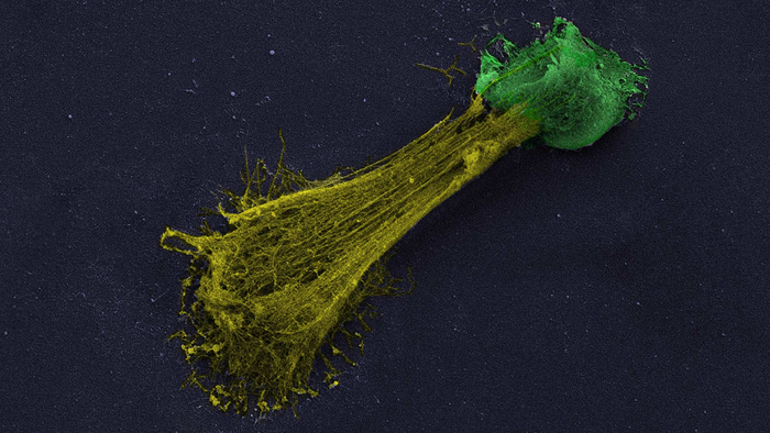 Neutrophils