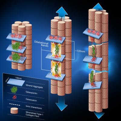 Researchers Pinpoint the Origin of Bone Fractures
