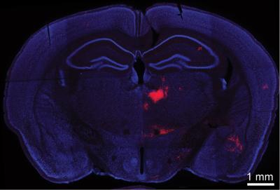 Link between 2 Key Brain Areas Involved in Schizophrenia