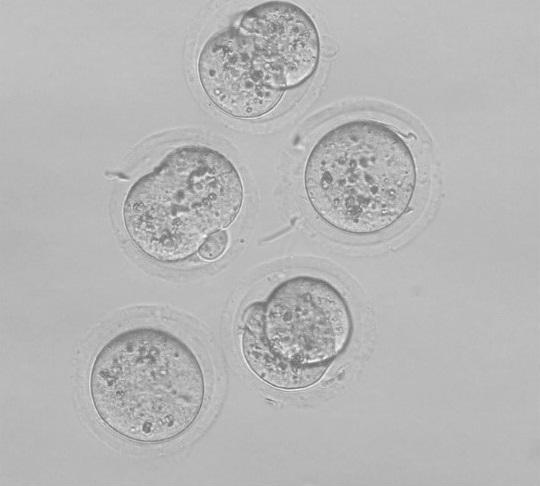 Two-Cell Stage Embryos Fertilized with Sperm Collected by a Novel Cell Sorting Device