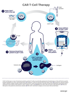 CAR T cell Therapy Explainer