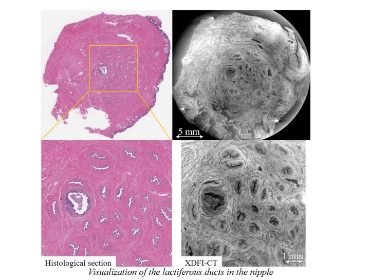 Visualization of the lactiferous ducts in the nipple