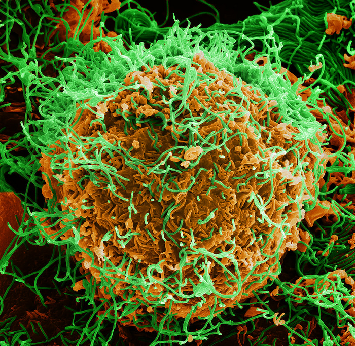 Ebola virus particles [IMAGE] | EurekAlert! Science News Releases