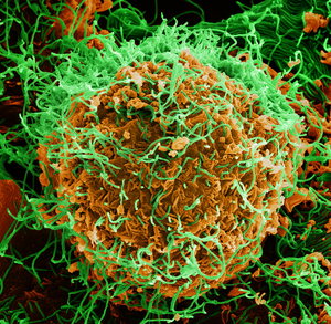 Ebola virus particles