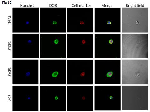 Expression and Localization of Opioid Receptors in Male Germ Cells