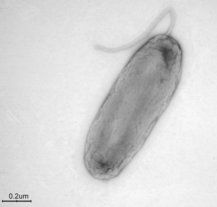 TEM microscope image of Legionella bononiensis bacterium