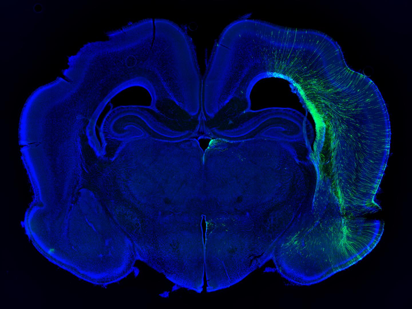 Mutant ferrets offer clues to human brain siz EurekAlert!