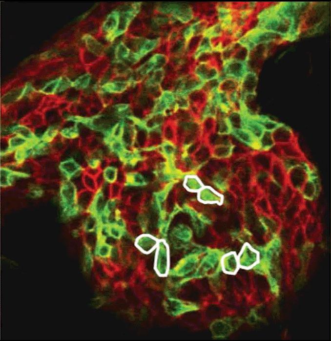 Live-Aufnahme von Stammzellen, die sich zufÃ¤llig im BrustdrÃ¼sengewebe bewegen