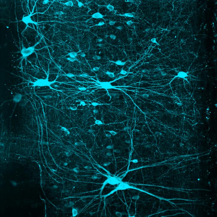 Salk Institute -- Pfaff Lab -- V2a Interneurons