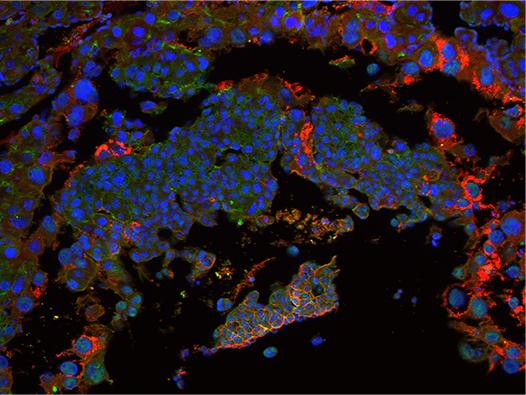 Cells of a Mutant Mouse Placenta
