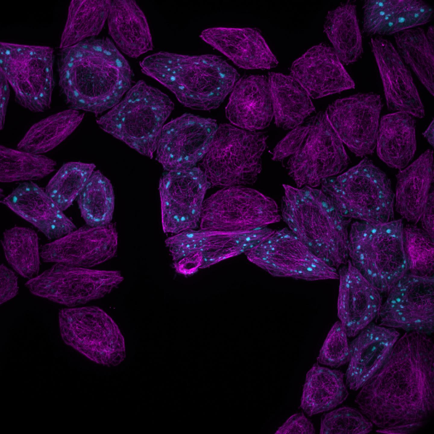 Fluorescence microscopy image 2