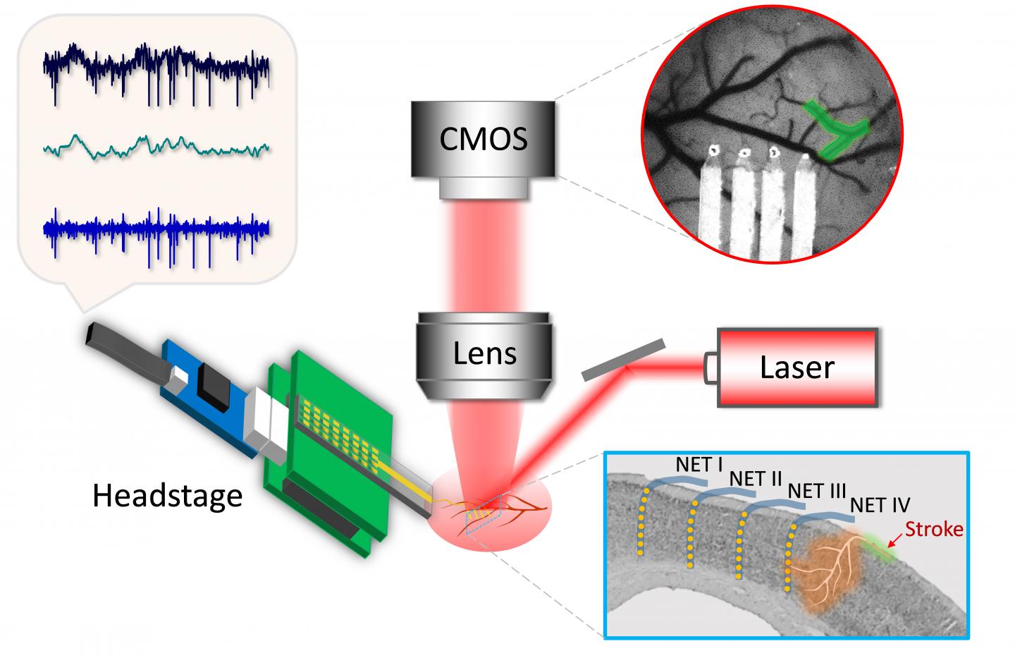 NEURO 1