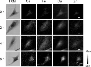 Synchrotron-based X-ray microscopy for studying the dynamic changes of ions in Alzheimer's disease cells.