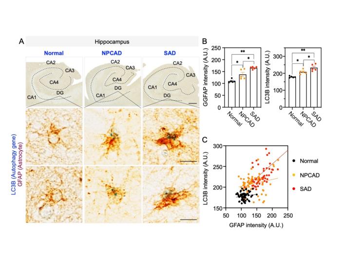 Increased expression of astrocyte-specific autophagy genes was observed in the brain tissues of AD patients