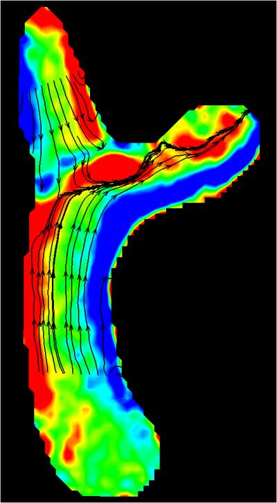 Blood Flow Simulation