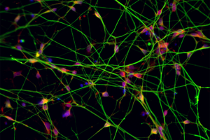 Stem cell-derived neurons