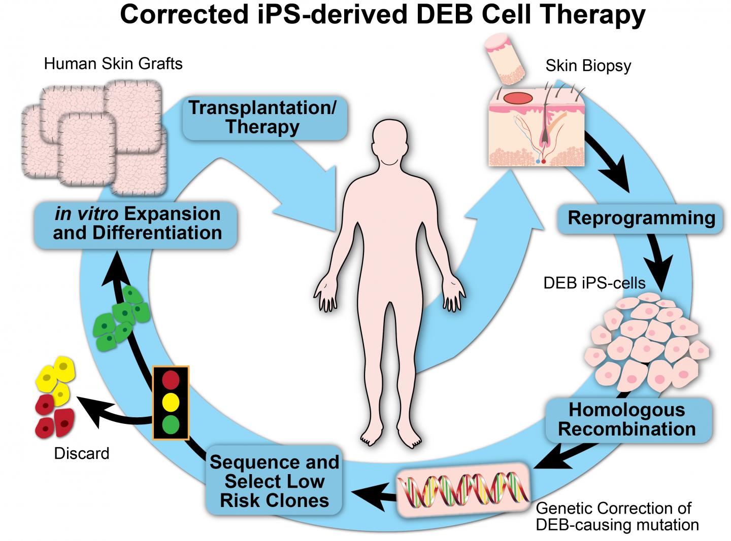 Stem Cells Correct Diseased Human Skin