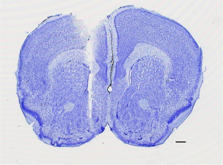 Studying Mice on Psychostimulants to Detect a Dopamine Receptor's Function (1 of 5)