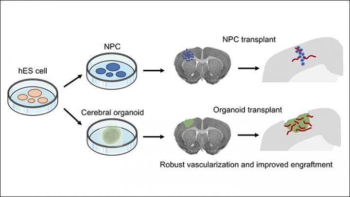 Organoid Transplant