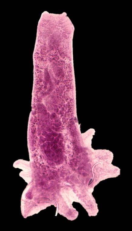 <i>Trinigyrus peregrinus</i>, New Parasite Species First Identified in 2015 by Hiroshima University