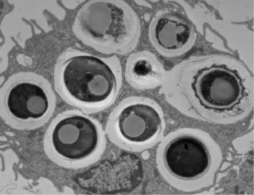 D. hansenii infected macrophage