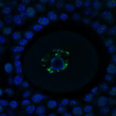 Egg Cell Inside Mouse Ovary (1 of 2)