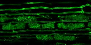 Plant-Microbe interactions