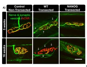 NANOG gene could aid muscle function after traumatic nerve injuries