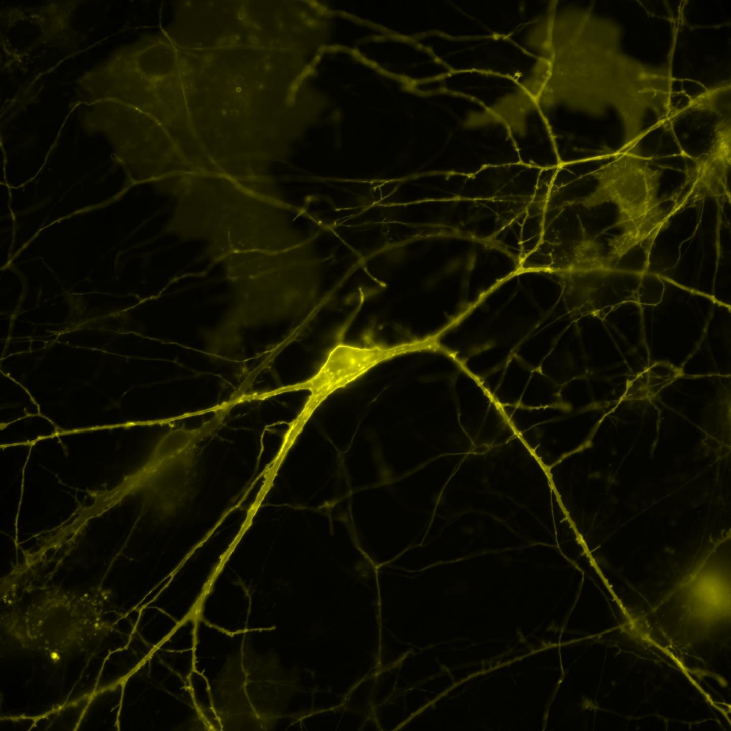 Voltron in a Mouse Neuron