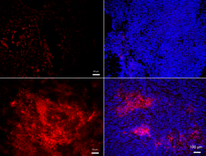 Oxidized LDL and Neutrophil accumulation