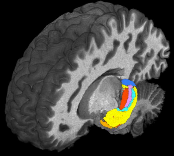 Ultra-high field MRI