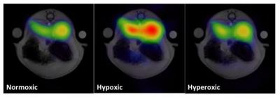 Hyperpolarized MRI