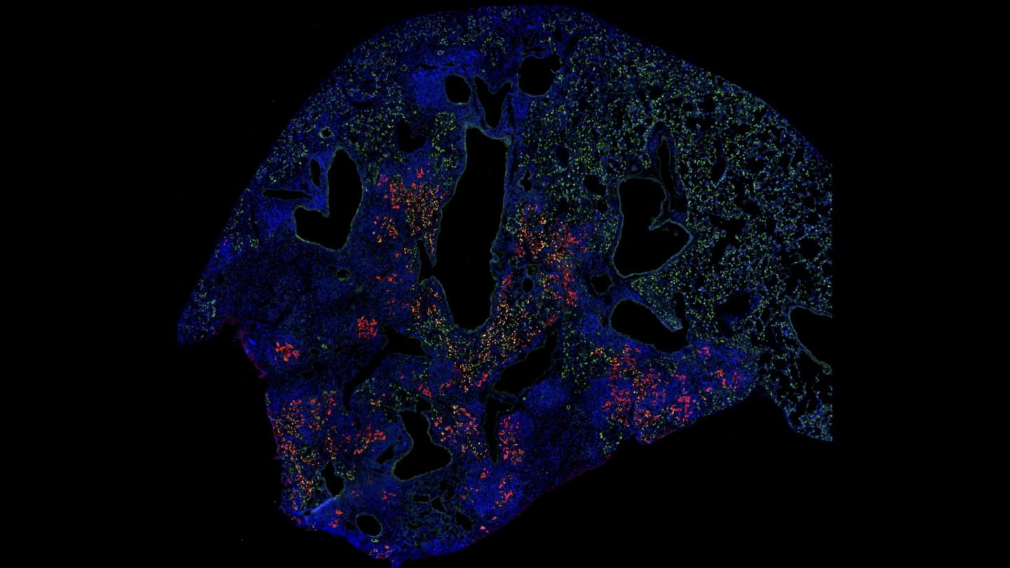 Regeneration in the Lungs after Flu