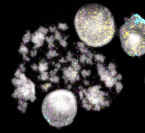 Nuclei and chromosomes of neuroblastoma cells