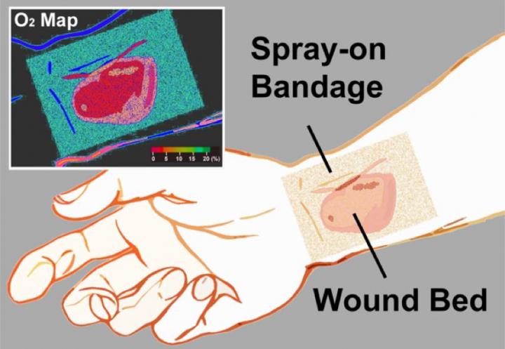 'Smart' Bandage Shows Tissue Oxygen Levels