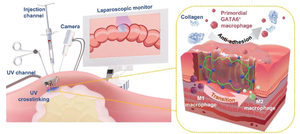 Newly developed approach to prevent postoperative adhesions