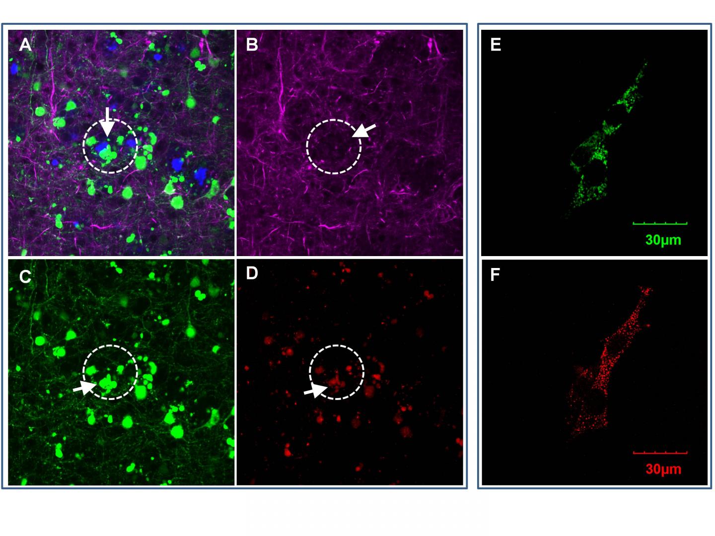 EBiomedicine Jan. 2020 - OCIAD1