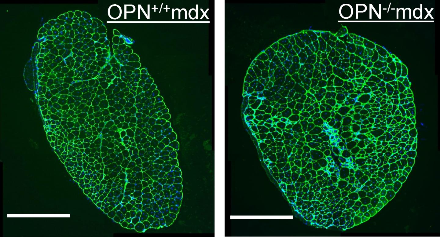 Removing Osteopontin Ameliorates the Symptoms of Muscular Dystrophy in Mice
