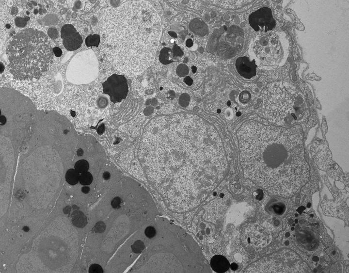 The ultra-structural section of a part of the embryo (dark, bottom left) surrounded by the placenta