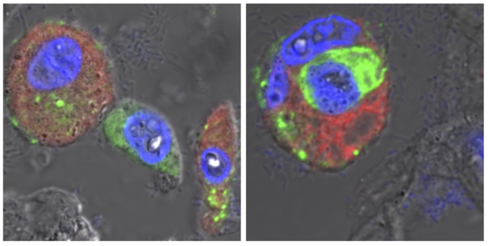 Microscopy images of lung tissue