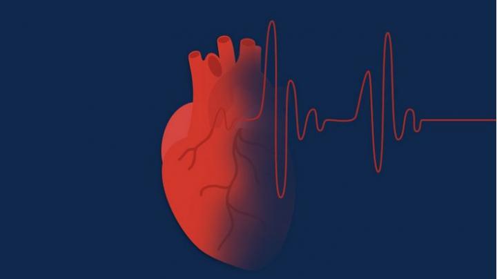 Medication Adherence a Problem in Atrial Fibrillation Patients